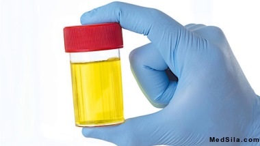 Банка с мочой